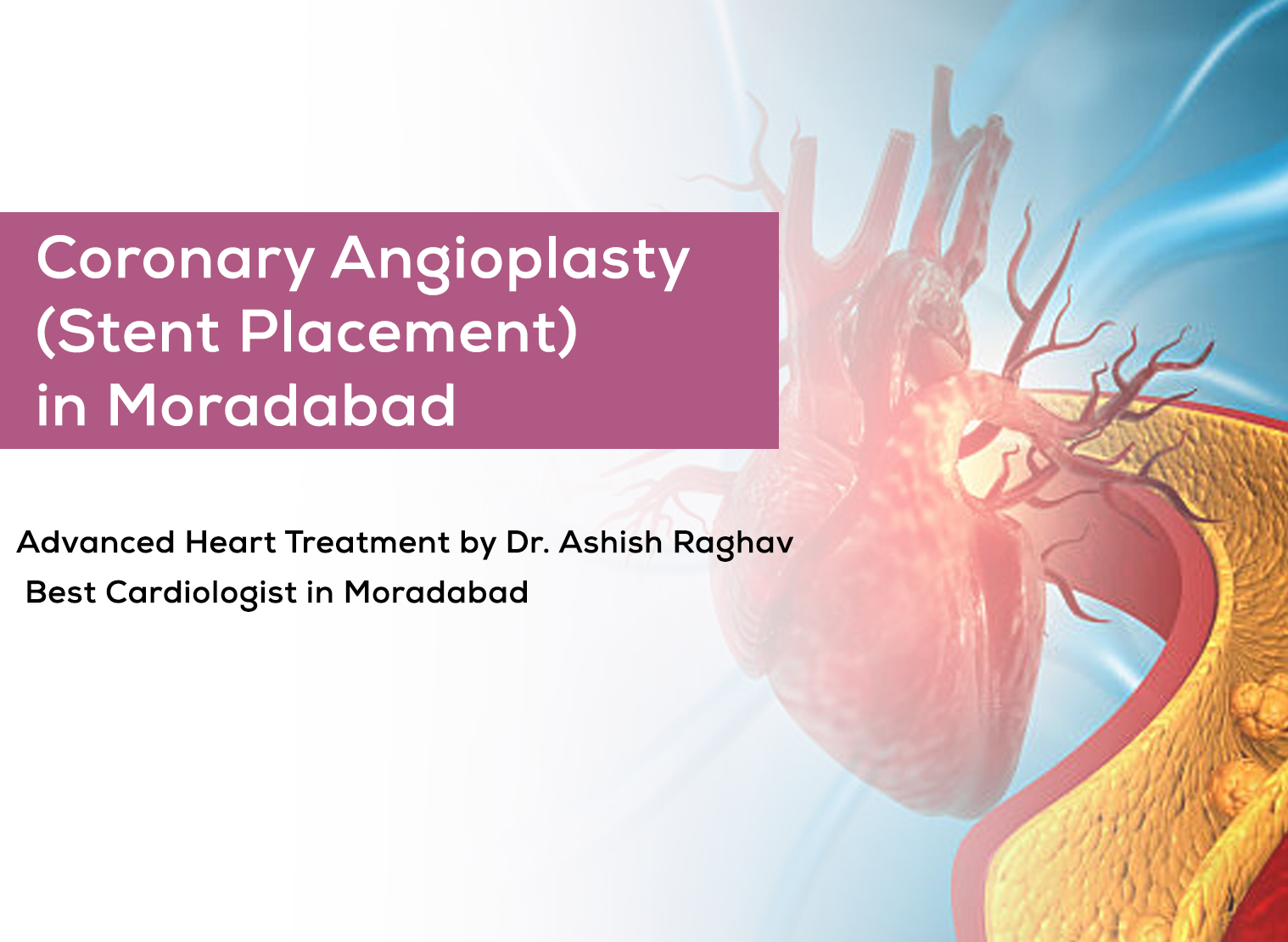 Coronary Angiography in Moradabad